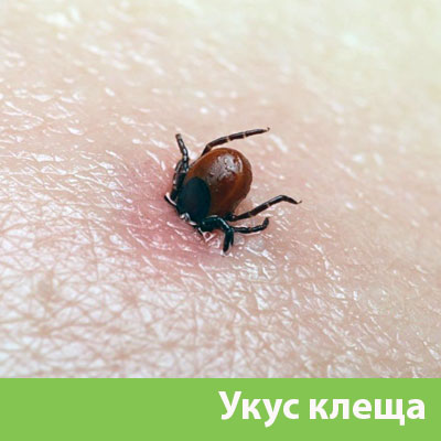 Укус клеща в Новочебоксарске
