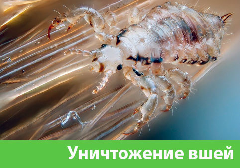 Уничтожение вшей в городе Новочебоксарск